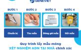 Quy trình lấy mẫu móng tay móng chân xét nghiệm ADN chính xác, đơn giản tại nhà