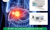Địa chỉ mua máy đốt sóng cao tần u gan chính hãng, giá tốt