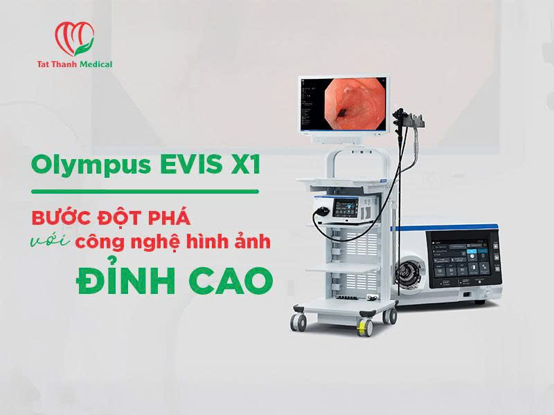 Đột phá trong chẩn đoán nội soi: Giới thiệu hệ thống Olympus Evis X1