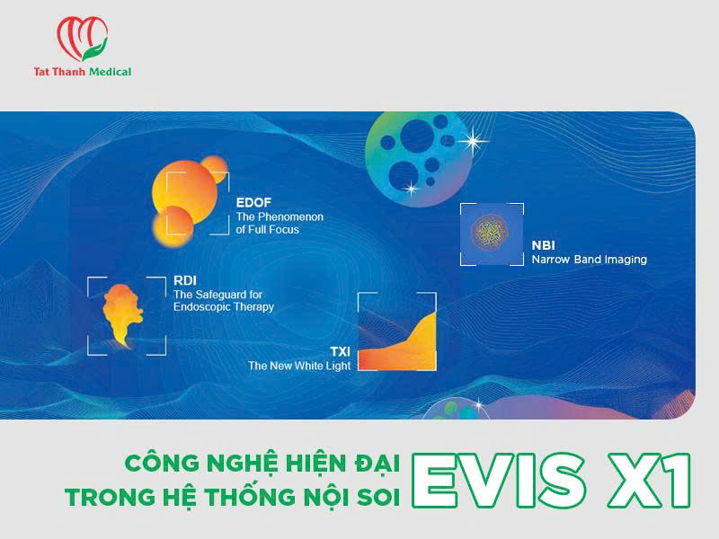 Đột phá trong chẩn đoán nội soi: Giới thiệu hệ thống Olympus Evis X1