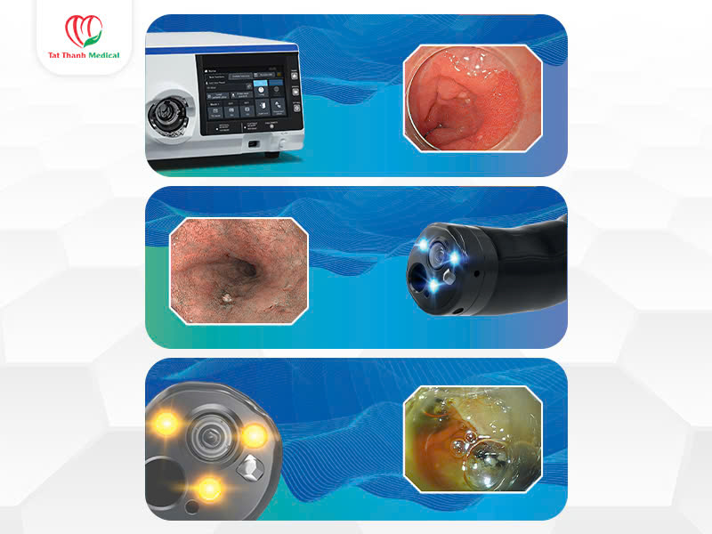 hệ thống nội soi tiêu hóa dạ dày đại tràng 