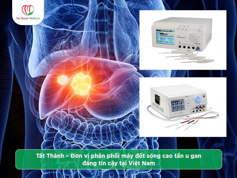 Địa chỉ mua máy đốt sóng cao tần u gan chính hãng, giá tốt