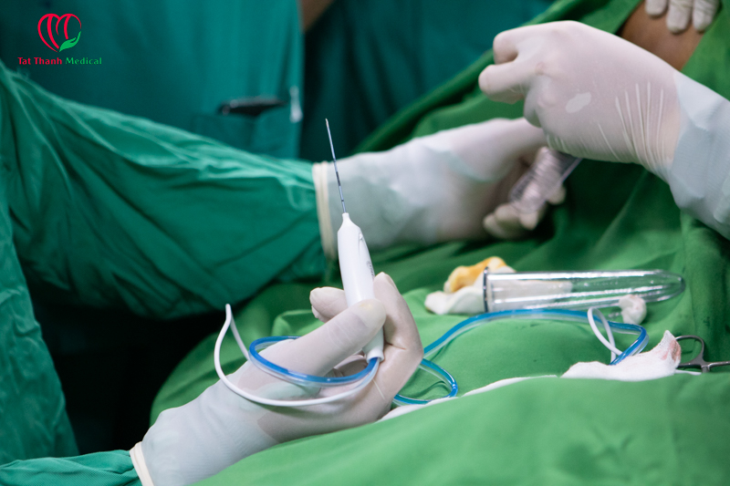 Hội thảo quốc tế cập nhật kỹ thuật đốt sóng cao tần RFA trong điều trị trĩ – Thành công từ thực tiễn lâm sàng